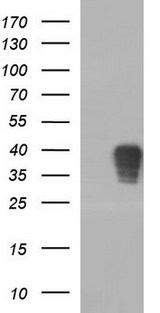 Apolipoprotein A-V Antibody - HEK293T cells were transfected with the pCMV6-ENTRY control (Left lane) or pCMV6-ENTRY APOA5 (Right lane) cDNA for 48 hrs and lysed. Equivalent amounts of cell lysates (5 ug per lane) were separated by SDS-PAGE and immunoblotted with anti-APOA5.