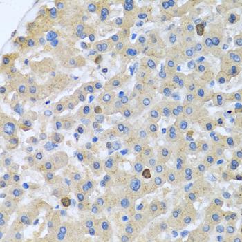 Apolipoprotein A-V Antibody - Immunohistochemistry of paraffin-embedded Human liver using APOA5 Polyclonal Antibody at dilution of 1:100 (40x lens).