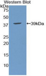 Apolipoprotein C-I Antibody - Western blot of recombinant Apolipoprotein C-I / APOC1.  This image was taken for the unconjugated form of this product. Other forms have not been tested.
