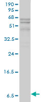 Apolipoprotein C-I Antibody - APOC1 monoclonal antibody (M01), clone 2E2-1A3. Western Blot analysis of APOC1 expression in human liver.