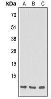 Apolipoprotein C-I Antibody - Western blot analysis of Apolipoprotein C1 expression in HEK293T (A); NS-1 (B); H9C2 (C) whole cell lysates.