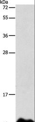 Apolipoprotein C-I Antibody - Western blot analysis of Human fetal liver tissue, using APOC1 Polyclonal Antibody at dilution of 1:500.