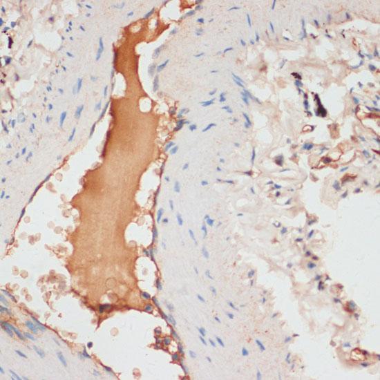 Apolipoprotein C-I Antibody - Immunohistochemistry of paraffin-embedded Human lung using APOC1 Polyclonal Antibody at dilution of 1:100 (40x lens).