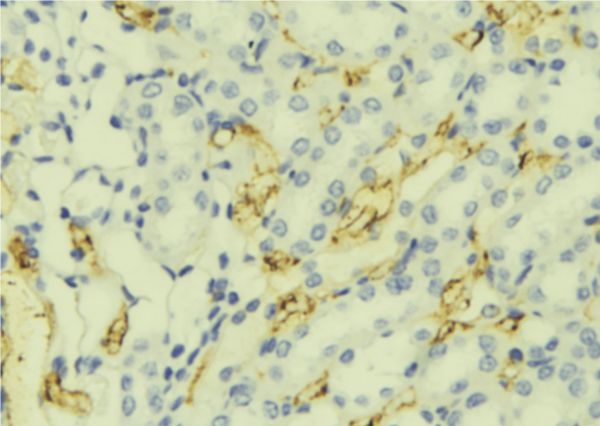 Apolipoprotein SAA Antibody - 1:100 staining mouse liver tissue by IHC-P. The sample was formaldehyde fixed and a heat mediated antigen retrieval step in citrate buffer was performed. The sample was then blocked and incubated with the antibody for 1.5 hours at 22°C. An HRP conjugated goat anti-rabbit antibody was used as the secondary.