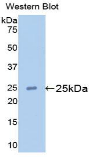 APOM / Apolipoprotein M Antibody - Western blot of recombinant APOM / Apolipoprotein M.  This image was taken for the unconjugated form of this product. Other forms have not been tested.