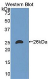 APOM / Apolipoprotein M Antibody - Western blot of recombinant APOM / Apolipoprotein M.