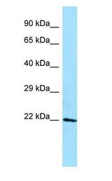APOM / Apolipoprotein M Antibody - APOM / Apolipoprotein M antibody Western Blot of ACHN.  This image was taken for the unconjugated form of this product. Other forms have not been tested.
