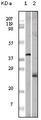 APOM / Apolipoprotein M Antibody - Apolipoprotein M Antibody in Western Blot (WB)