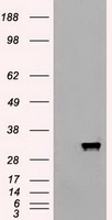 APOM / Apolipoprotein M Antibody - HEK293T cells were transfected with the pCMV6-ENTRY control (Left lane) or pCMV6-ENTRY APOM (Right lane) cDNA for 48 hrs and lysed. Equivalent amounts of cell lysates (5 ug per lane) were separated by SDS-PAGE and immunoblotted with anti-APOM.