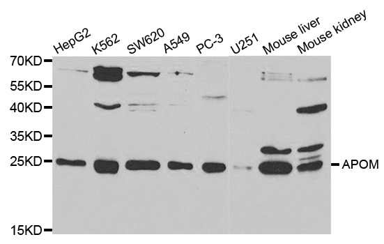 APOM / Apolipoprotein M Antibody - Western blot analysis of extracts of various cell lines, using APOM antibody.