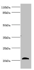 APOM / Apolipoprotein M Antibody - Western blot All Lanes:APOM antibody at 3.93ug/ml+mouse placenta tissue Secondary Goat polyclonal to rabbit at 1/10000 dilution Predicted band size: 22,14 kDa Observed band size: 21 kDa