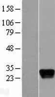 APOM / Apolipoprotein M Protein - Western validation with an anti-DDK antibody * L: Control HEK293 lysate R: Over-expression lysate