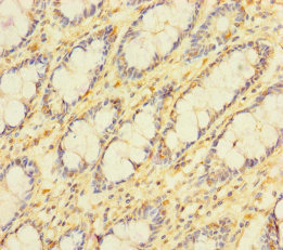 APOOL / Apolipoprotein O-Like Antibody - Immunohistochemistry of paraffin-embedded human rectum tissue using APOOL Antibody at dilution of 1:100