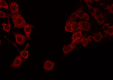 APOOL / Apolipoprotein O-Like Antibody - Staining COLO205 cells by IF/ICC. The samples were fixed with PFA and permeabilized in 0.1% Triton X-100, then blocked in 10% serum for 45 min at 25°C. The primary antibody was diluted at 1:200 and incubated with the sample for 1 hour at 37°C. An Alexa Fluor 594 conjugated goat anti-rabbit IgG (H+L) Ab, diluted at 1/600, was used as the secondary antibody.