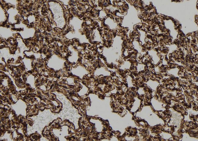 Apoptosis related protein (APR-2) Antibody - 1:100 staining rat lung tissue by IHC-P. The sample was formaldehyde fixed and a heat mediated antigen retrieval step in citrate buffer was performed. The sample was then blocked and incubated with the antibody for 1.5 hours at 22°C. An HRP conjugated goat anti-rabbit antibody was used as the secondary.