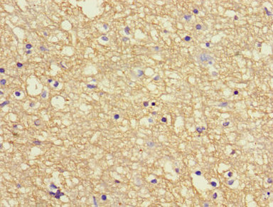 APP / Beta Amyloid Precursor Antibody - Immunohistochemistry of paraffin-embedded human brain tissue using APP Antibody at dilution of 1:100