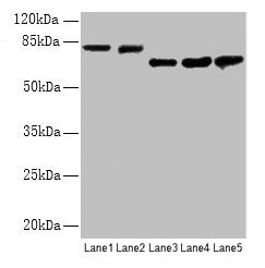APP / Beta Amyloid Precursor Antibody - Western blot All lanes: Amyloid beta A4 antibody at 2.4µg/ml Lane 1: Mouse brain tissue Lane 2: Mouse kidney tissue Lane 3: Mouse lung tissue Lane 4: 293 whole cell lysate Lane 5: A549 whole cell lysate Lane 6: U251 whole cell lysate Lane 7: SH-SY5Y whole cell lysate Secondary Goat polyclonal to rabbit IgG at 1/15000 dilution Predicted band size: 87, 35, 77, 79, 81, 83, 85, 86, 73, 84 kDa Observed band size: 33, 50, 73, 81 kDa