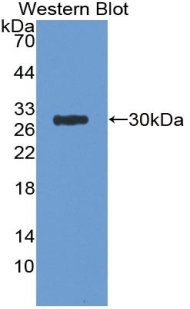 APP / Beta Amyloid Precursor Antibody - Western Blot; Sample: Recombinant protein.