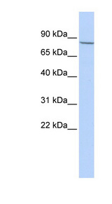 APP / Beta Amyloid Precursor Antibody - APP / Amyloid Precursor Protein antibody Western blot of MCF7 cell lysate. This image was taken for the unconjugated form of this product. Other forms have not been tested.