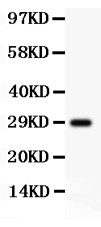 APP / Beta Amyloid Precursor Antibody - beta Amyloid antibody Western blot. All lanes: Anti beta Amyloid at 0.5 ug/ml. WB: Recombinant Human beta-Amyloid Protein 0.5ng. Predicted band size: 29 kD. Observed band size: 29 kD.