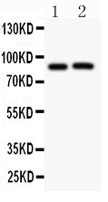 APP / Beta Amyloid Precursor Antibody - beta Amyloid antibody Western blot. All lanes: Anti beta Amyloid at 0.5 ug/ml. Lane 1: Rat Brain Tissue Lysate at 50 ug. Lane 2: Mouse Brain Tissue Lysate at 50 ug. Predicted band size: 87 kD. Observed band size: 87 kD.