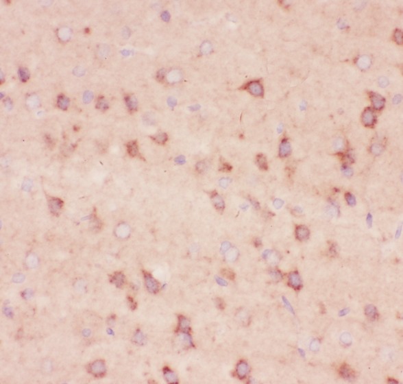 APP / Beta Amyloid Precursor Antibody - beta Amyloid antibody IHC-paraffin: Rat Brain Tissue.