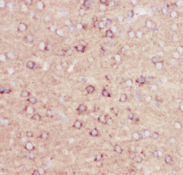 APP / Beta Amyloid Precursor Antibody - beta Amyloid antibody IHC-paraffin: Mouse Brain Tissue.