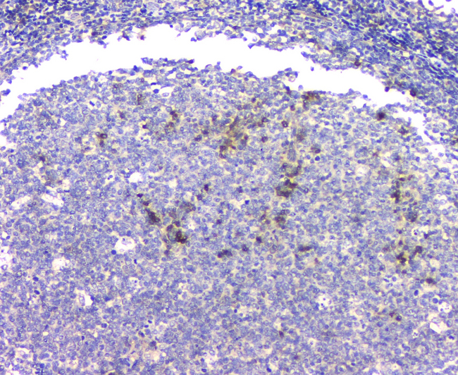 APP / Beta Amyloid Precursor Antibody - IHC analysis of APP using anti-APP antibody. APP was detected in paraffin-embedded section of human tonsil tissue. Heat mediated antigen retrieval was performed in citrate buffer (pH6, epitope retrieval solution) for 20 mins. The tissue section was blocked with 10% goat serum. The tissue section was then incubated with 1µg/ml rabbit anti-APP Antibody overnight at 4°C. Biotinylated goat anti-rabbit IgG was used as secondary antibody and incubated for 30 minutes at 37°C. The tissue section was developed using Strepavidin-Biotin-Complex (SABC) with DAB as the chromogen.