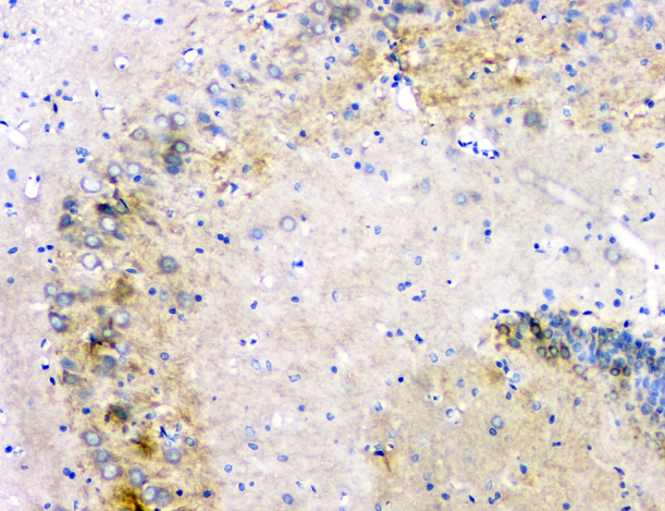 APP / Beta Amyloid Precursor Antibody - IHC analysis of APP using anti-APP antibody. APP was detected in paraffin-embedded section of rat brain tissue. Heat mediated antigen retrieval was performed in citrate buffer (pH6, epitope retrieval solution) for 20 mins. The tissue section was blocked with 10% goat serum. The tissue section was then incubated with 1µg/ml rabbit anti-APP Antibody overnight at 4°C. Biotinylated goat anti-rabbit IgG was used as secondary antibody and incubated for 30 minutes at 37°C. The tissue section was developed using Strepavidin-Biotin-Complex (SABC) with DAB as the chromogen.