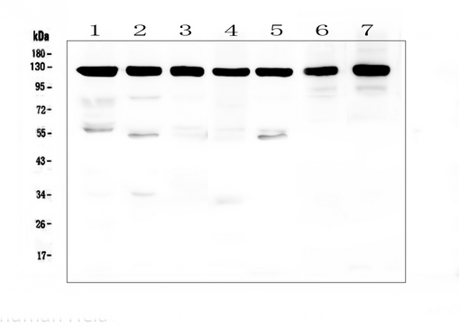 APP / Beta Amyloid Precursor Antibody - Western blot analysis of APP using anti-APP antibody. Electrophoresis was performed on a 5-20% SDS-PAGE gel at 70V (Stacking gel) / 90V (Resolving gel) for 2-3 hours. The sample well of each lane was loaded with 50ug of sample under reducing conditions. Lane 1: human Hela whole cell lysates,Lane 2: human U-87MG whole cell lysates,Lane 3: human T-47D whole cell lysates,Lane 4: human A549 whole cell lysates,Lane 5: human U2OS whole cell lysates,Lane 6: rat brain tissue lysates,Lane 7: mouse brain tissue lysates. After Electrophoresis, proteins were transferred to a Nitrocellulose membrane at 150mA for 50-90 minutes. Blocked the membrane with 5% Non-fat Milk/ TBS for 1.5 hour at RT. The membrane was incubated with rabbit anti-APP antigen affinity purified polyclonal antibody at 0.5 µg/mL overnight at 4°C, then washed with TBS-0.1% Tween 3 times with 5 minutes each and probed with a goat anti-rabbit IgG-HRP secondary antibody at a dilution of 1:10000 for 1.5 hour at RT. The signal is developed using an Enhanced Chemiluminescent detection (ECL) kit with Tanon 5200 system. A specific band was detected for APP at approximately 120KD. The expected band size for APP is at 87KD.