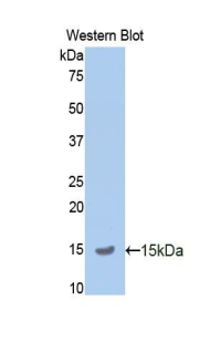 APP / Beta Amyloid Precursor Antibody - Western blot of recombinant APP / Beta Amyloid.  This image was taken for the unconjugated form of this product. Other forms have not been tested.