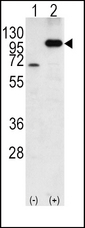 APP / Beta Amyloid Precursor Antibody - Western blot of APP (arrow) using rabbit polyclonal APP Antibody. 293 cell lysates (2 ug/lane) either nontransfected (Lane 1) or transiently transfected with the APP gene (Lane 2) (Origene Technologies).