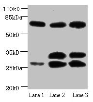 APP / Beta Amyloid Precursor Antibody - Western blot All lanes :Amyloid beta A4 antibody at 1ug/ml Lane 1: Mouse heart tissue Lane 2: Mouse kidney tissue Lane 3: Mouse lung tissue Secondary Goat polyclonal to Rabbit IgG at 1/15000 dilution Predicted band size : 30,35,72,80 kDa Observed band size : 30,35,72 kDa