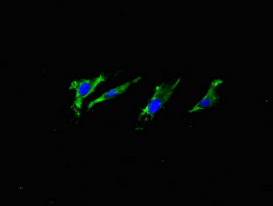 APP / Beta Amyloid Precursor Antibody - Immunofluorescent analysis of Hela cells using APP Monoclonal Antibody at a dilution of 1:100 and Alexa Fluor 488-congugated AffiniPure Goat Anti-Rabbit IgG(H+L)