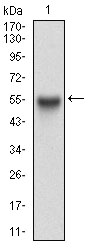APP / Beta Amyloid Precursor Antibody - Western blot analysis using APP mAb against human APP (AA: 483-699) recombinant protein. (Expected MW is 50.7 kDa)