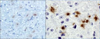APP / Beta Amyloid Precursor Antibody - Immunohistochemistry: beta Amyloid Antibody (MOAB-2) - IHC of beta Amyloid on normal mouse brain (left) and 5xFAD mouse brain (right) using DAB with hematoxylin counterstain. The MOAB-2 antibody was used at 1:20 on normal mouse brain and at 1:400 on 5xFAD mouse brain.  This image was taken for the unconjugated form of this product. Other forms have not been tested.