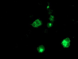 APP / Beta Amyloid Precursor Antibody - Anti-APP mouse monoclonal antibody immunofluorescent staining of COS7 cells transiently transfected by pCMV6-ENTRY APP.