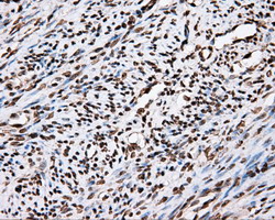 APP / Beta Amyloid Precursor Antibody - IHC of paraffin-embedded Human endometrium tissue using anti-APP mouse monoclonal antibody.