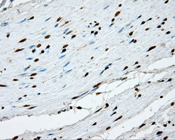 APP / Beta Amyloid Precursor Antibody - IHC of paraffin-embedded Human colon tissue using anti-APP mouse monoclonal antibody.