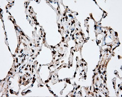 APP / Beta Amyloid Precursor Antibody - IHC of paraffin-embedded Human lung tissue using anti-APP mouse monoclonal antibody.