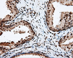 APP / Beta Amyloid Precursor Antibody - IHC of paraffin-embedded Human prostate tissue using anti-APP mouse monoclonal antibody.