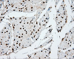 APP / Beta Amyloid Precursor Antibody - IHC of paraffin-embedded Human bladder tissue using anti-APP mouse monoclonal antibody.