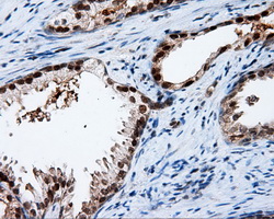 APP / Beta Amyloid Precursor Antibody - IHC of paraffin-embedded prostate tissue using anti-APP mouse monoclonal antibody. (Dilution 1:50).