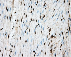 APP / Beta Amyloid Precursor Antibody - Immunohistochemical staining of paraffin-embedded Human colon tissue using anti-APP mouse monoclonal antibody.