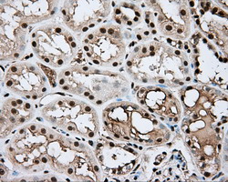 APP / Beta Amyloid Precursor Antibody - Immunohistochemical staining of paraffin-embedded Human Kidney tissue using anti-APP mouse monoclonal antibody.