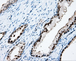 APP / Beta Amyloid Precursor Antibody - IHC of paraffin-embedded prostate tissue using anti-APP mouse monoclonal antibody. (Dilution 1:50).