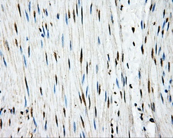 APP / Beta Amyloid Precursor Antibody - IHC of paraffin-embedded colon tissue using anti-APP mouse monoclonal antibody. (Dilution 1:50).