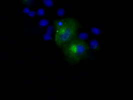 APP / Beta Amyloid Precursor Antibody - Anti-APP mouse monoclonal antibody  immunofluorescent staining of COS7 cells transiently transfected by pCMV6-ENTRY APP.