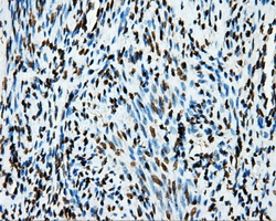 APP / Beta Amyloid Precursor Antibody - IHC of paraffin-embedded endometrium tissue using anti-APP mouse monoclonal antibody. (Dilution 1:50).