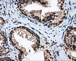 APP / Beta Amyloid Precursor Antibody - IHC of paraffin-embedded prostate tissue using anti-APP mouse monoclonal antibody. (Dilution 1:50).